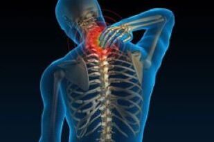 osteochondrosis cervical rê li ber qirikê diqulipîne