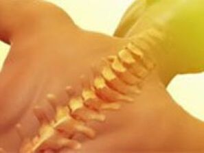 OsteochondRosis - Nexweşiya Spine