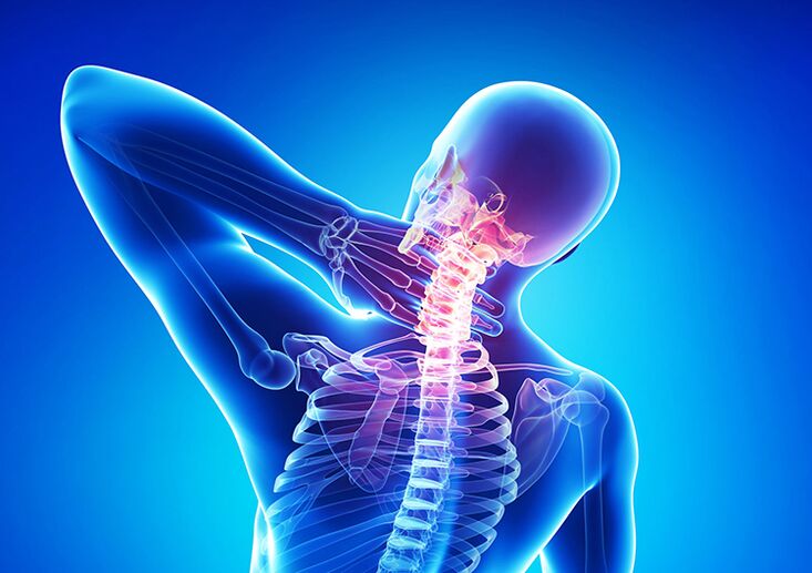 Osteochondrosis spinal nexweşiyek e ku bandorê li kartil û vertebras dike.