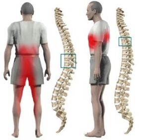 Protrusions di spine
